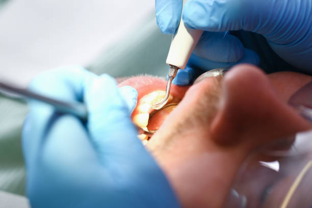 Best Weekend Emergency Dentist in Oberlin, OH